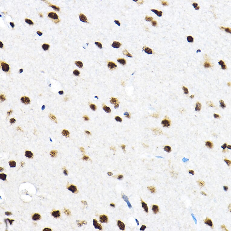 Immunohistochemistry - Anti-SF3A3 Antibody (A14572) - Antibodies.com