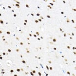 Immunohistochemistry - Anti-SF3A3 Antibody (A14572) - Antibodies.com