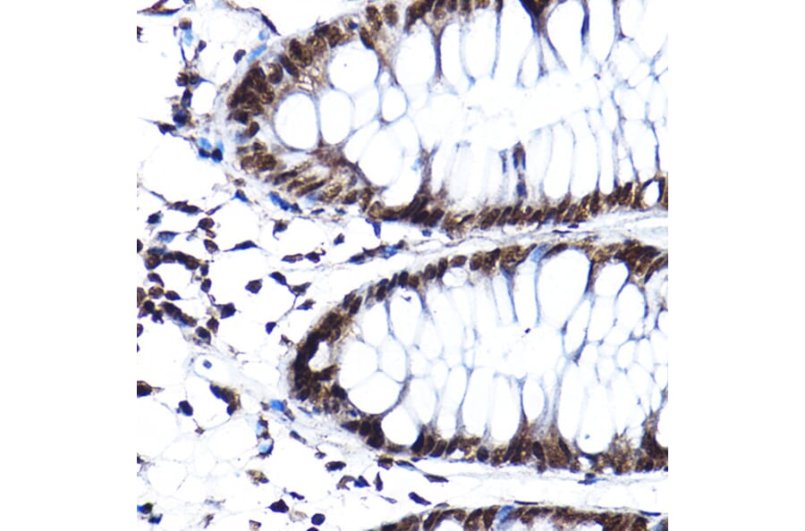Immunohistochemistry - Anti-SF3A3 Antibody (A14572) - Antibodies.com