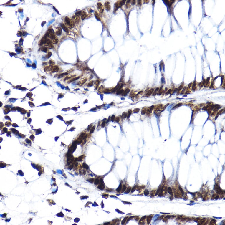 Immunohistochemistry - Anti-SF3A3 Antibody (A14572) - Antibodies.com