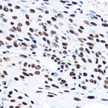 Immunohistochemistry - Anti-SF3A3 Antibody (A14572) - Antibodies.com