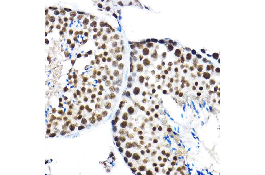 Immunohistochemistry - Anti-SF3A3 Antibody (A14572) - Antibodies.com