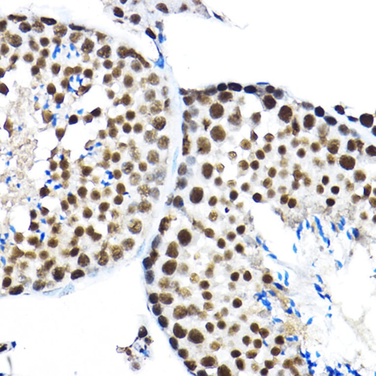Immunohistochemistry - Anti-SF3A3 Antibody (A14572) - Antibodies.com