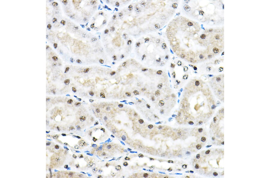 Immunohistochemistry - Anti-SF3A3 Antibody (A14572) - Antibodies.com
