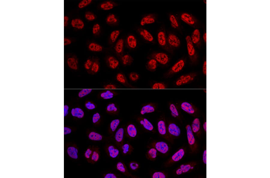 Immunofluorescence - Anti-SF3A3 Antibody (A14572) - Antibodies.com