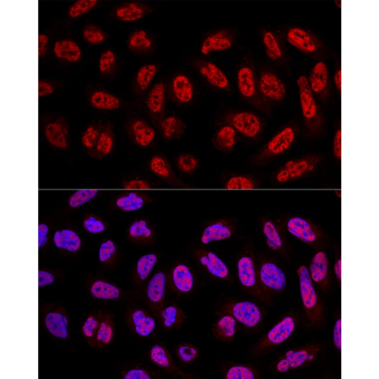 Immunofluorescence - Anti-SF3A3 Antibody (A14572) - Antibodies.com