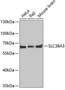 Western blot analysis of extracts of various cell lines, using Anti-SLC38A3 Antibody (A4472).
Secondary antibody: Goat Anti-Rabbit IgG (H+L) (HRP) (AS014) at 1:10,000 dilution.
Lysates / proteins: 25µg per lane.
Blocking buffer: 3% non-fat dry milk in TBST.