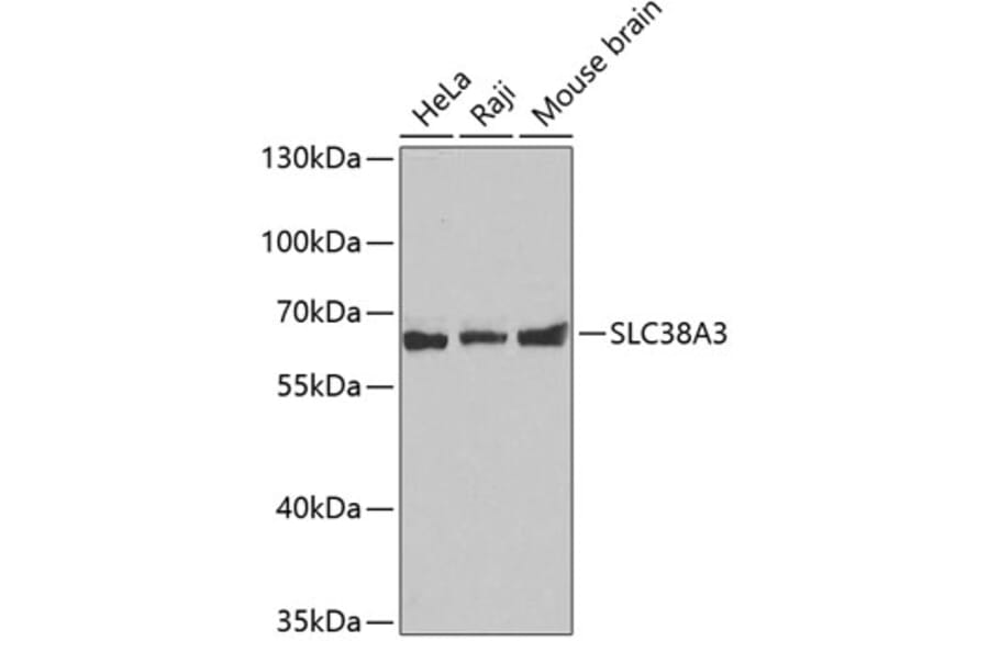 Western Blot - Anti-SLC38A3/SN1 Antibody (A14573) - Antibodies.com