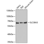 Western Blot - Anti-SLC38A3/SN1 Antibody (A14573) - Antibodies.com