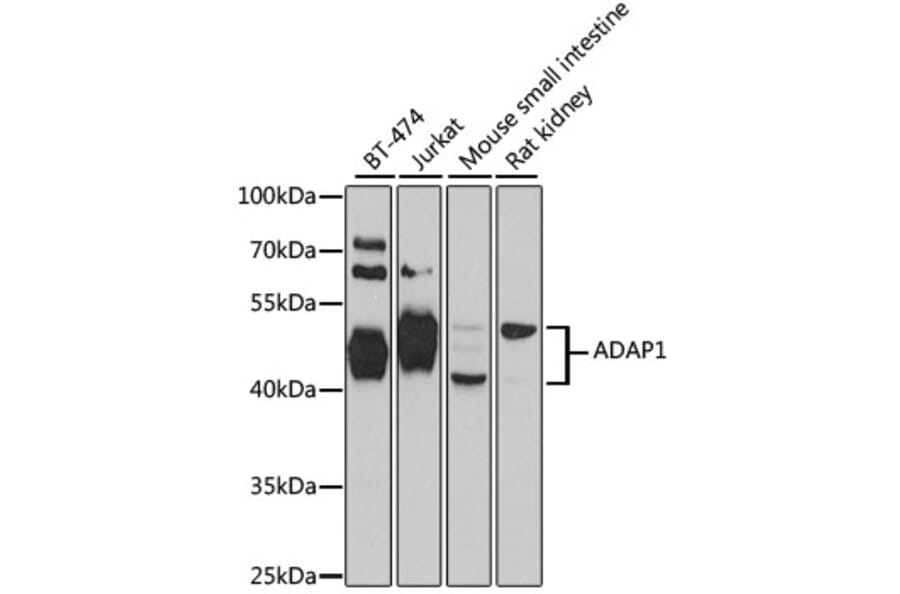Western Blot - Anti-ADAP1 Antibody (A4479) - Antibodies.com