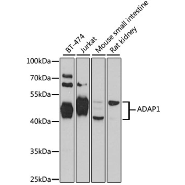 Western Blot - Anti-ADAP1 Antibody (A4479) - Antibodies.com