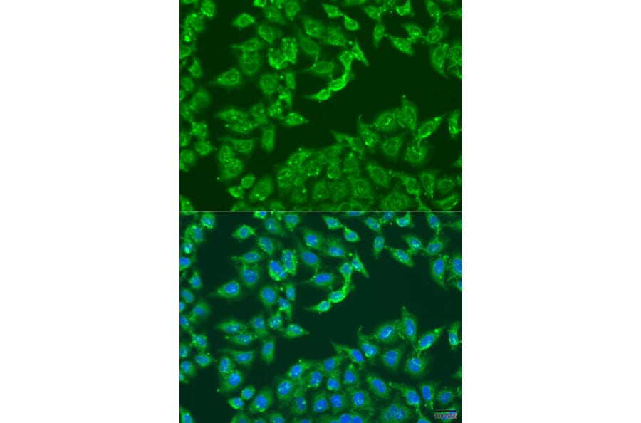 Immunofluorescence - Anti-ADAP1 Antibody (A4479) - Antibodies.com