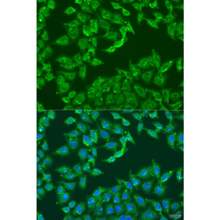 Immunofluorescence - Anti-ADAP1 Antibody (A4479) - Antibodies.com