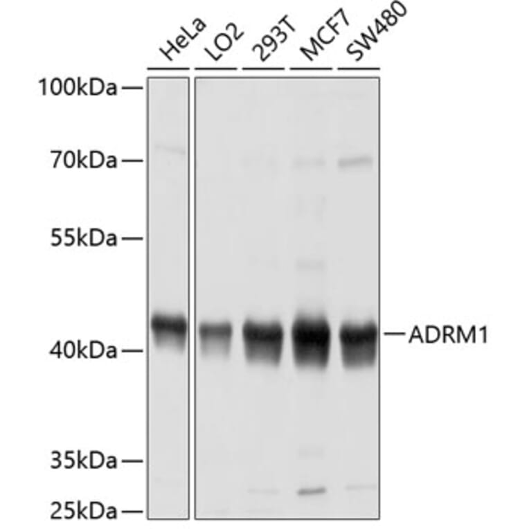 Western Blot - Anti-ADRM1/ARM-1 Antibody (A14575) - Antibodies.com