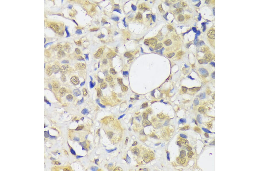 Immunohistochemistry - Anti-ADRM1/ARM-1 Antibody (A14575) - Antibodies.com