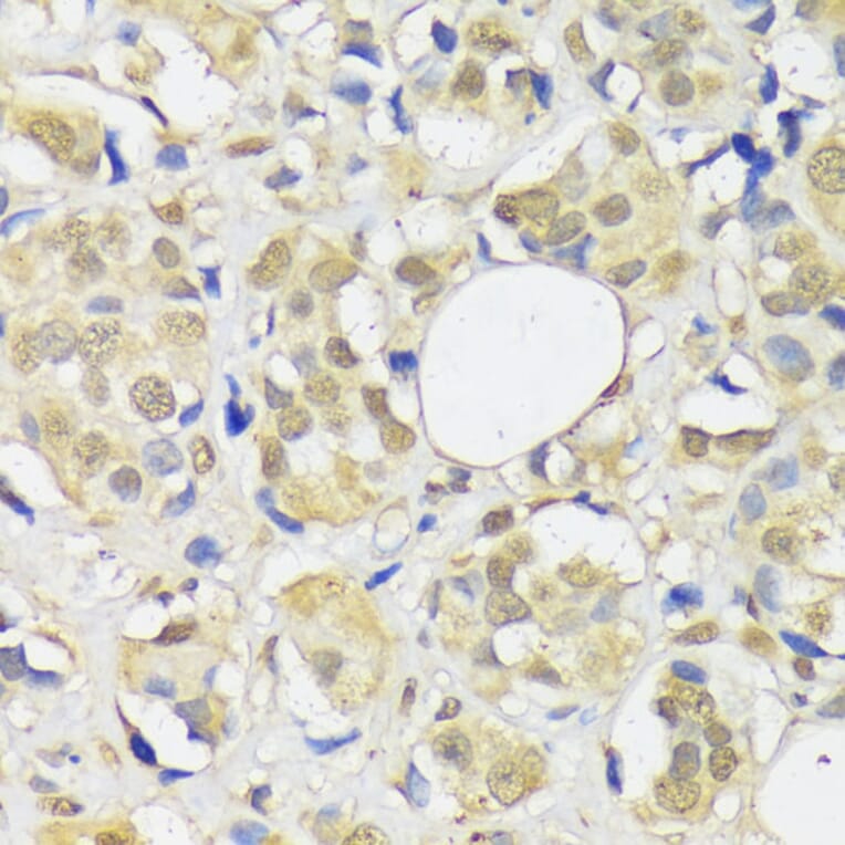 Immunohistochemistry - Anti-ADRM1/ARM-1 Antibody (A14575) - Antibodies.com