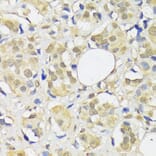 Immunohistochemistry - Anti-ADRM1/ARM-1 Antibody (A14575) - Antibodies.com