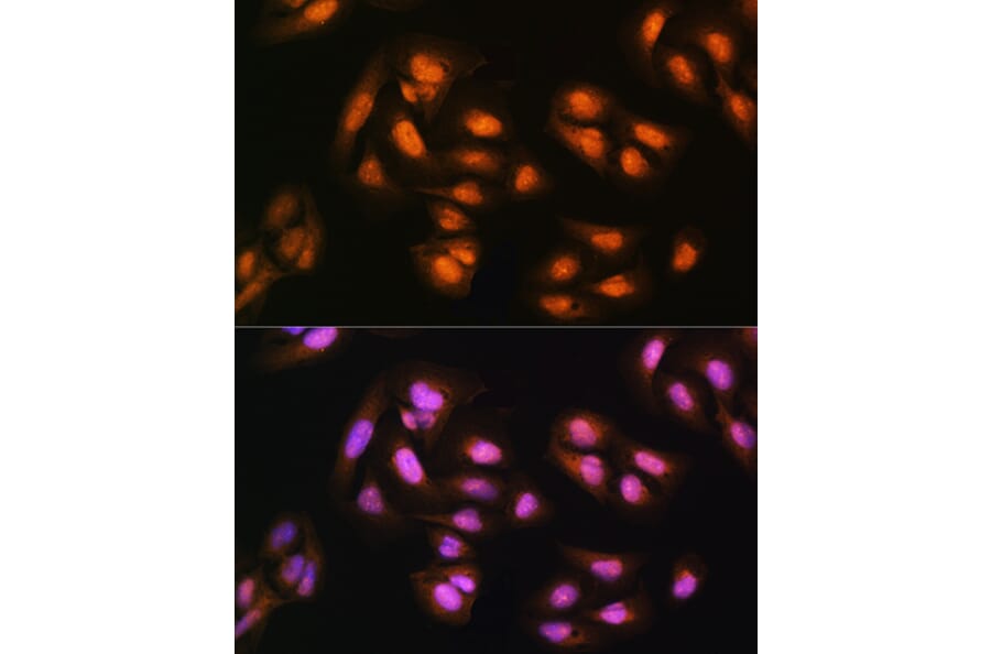 Immunofluorescence - Anti-ADRM1/ARM-1 Antibody (A14575) - Antibodies.com