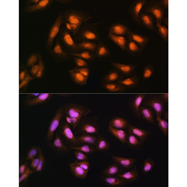 Immunofluorescence - Anti-ADRM1/ARM-1 Antibody (A14575) - Antibodies.com