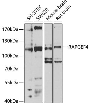Western blot analysis of extracts of various cell lines, using Anti-RAPGEF4 Antibody (A4484) at 1:1,000 dilution.
Secondary antibody: Goat Anti-Rabbit IgG (H+L) (HRP) (AS014) at 1:10,000 dilution.
Lysates / proteins: 25µg per lane.
Blocking buffer: 3% non-fat dry milk in TBST.
Detection: ECL Enhanced Kit (RM00021).
Exposure time: 30s.