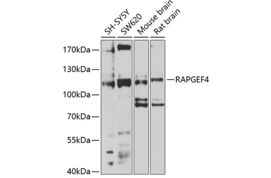 Western Blot - Anti-Epac2 Antibody (A14576) - Antibodies.com