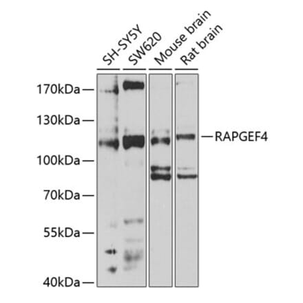 Western Blot - Anti-Epac2 Antibody (A14576) - Antibodies.com