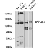 Western Blot - Anti-Epac2 Antibody (A14576) - Antibodies.com