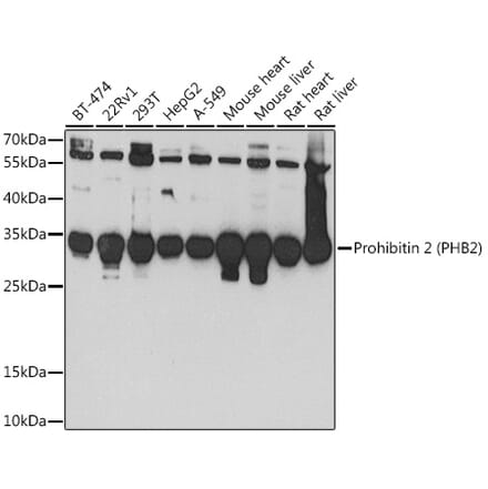 Western Blot - Anti-REA Antibody (A14577) - Antibodies.com