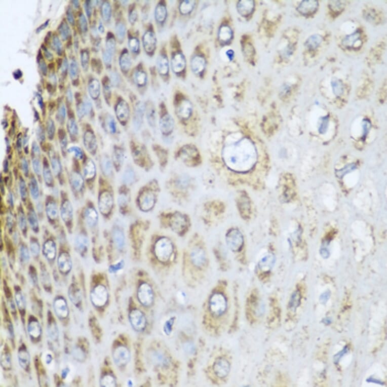 Immunohistochemistry - Anti-REA Antibody (A14577) - Antibodies.com