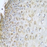 Immunohistochemistry - Anti-REA Antibody (A14577) - Antibodies.com