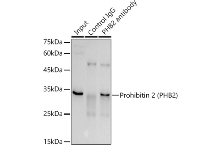 Western Blot - Anti-REA Antibody (A14577) - Antibodies.com