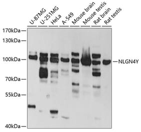 Western Blot - Anti-Neuroligin 4 Antibody (A14578) - Antibodies.com