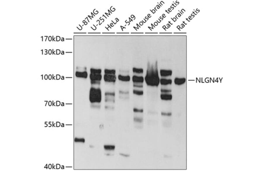 Western Blot - Anti-Neuroligin 4 Antibody (A14578) - Antibodies.com