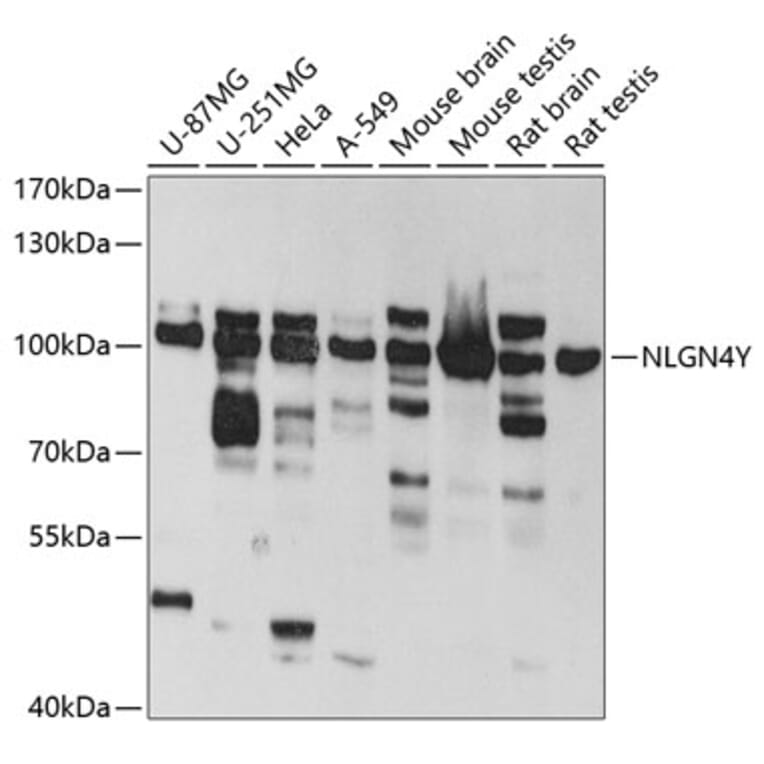 Western Blot - Anti-Neuroligin 4 Antibody (A14578) - Antibodies.com