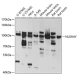 Western Blot - Anti-Neuroligin 4 Antibody (A14578) - Antibodies.com