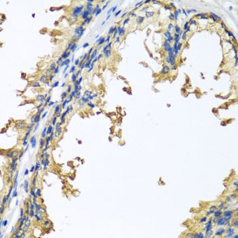 Immunohistochemistry - Anti-Neuroligin 4 Antibody (A14578) - Antibodies.com