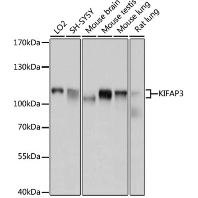 Western Blot - Anti-KIFAP3 Antibody (A14579) - Antibodies.com