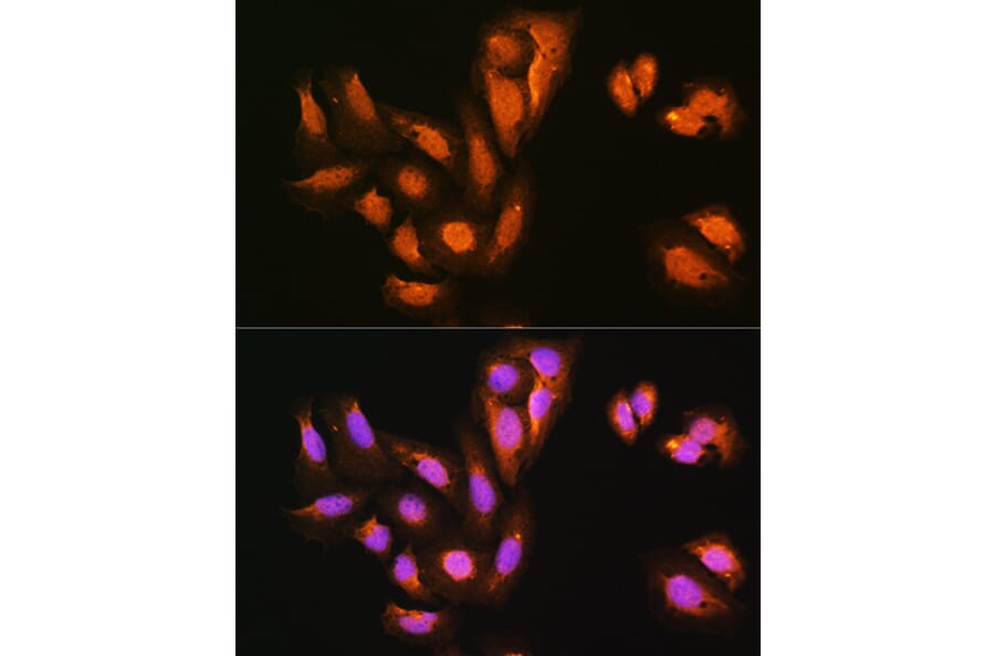 Immunofluorescence - Anti-KIFAP3 Antibody (A14579) - Antibodies.com