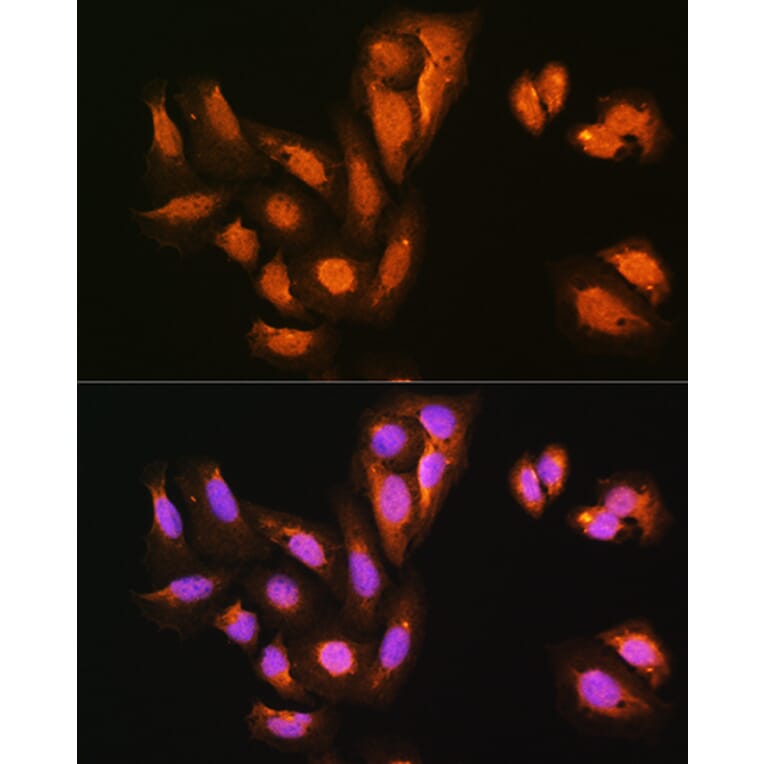 Immunofluorescence - Anti-KIFAP3 Antibody (A14579) - Antibodies.com