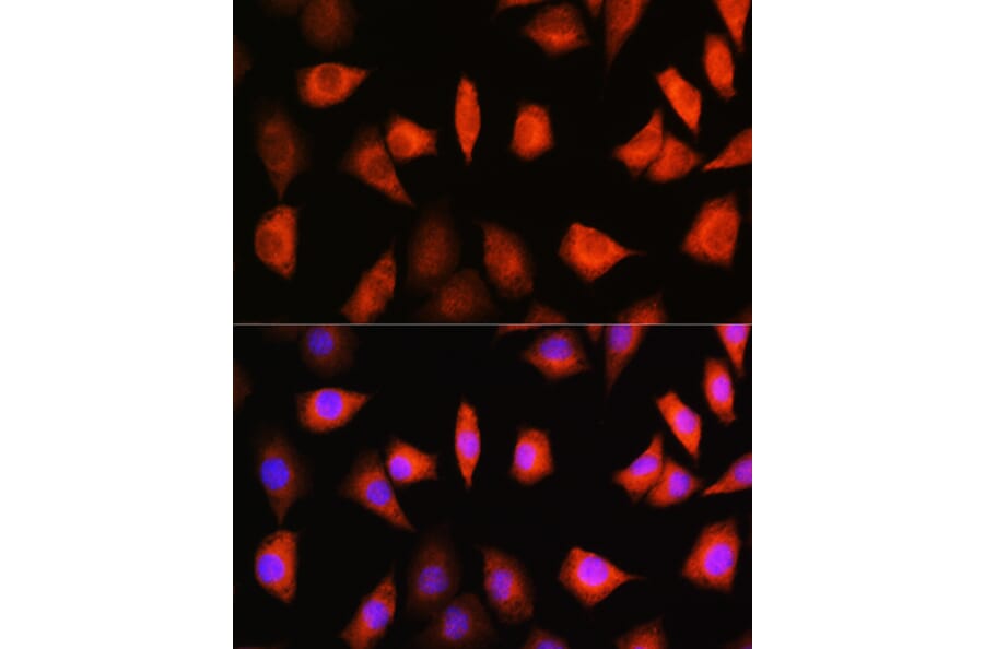Immunofluorescence - Anti-KIFAP3 Antibody (A14579) - Antibodies.com