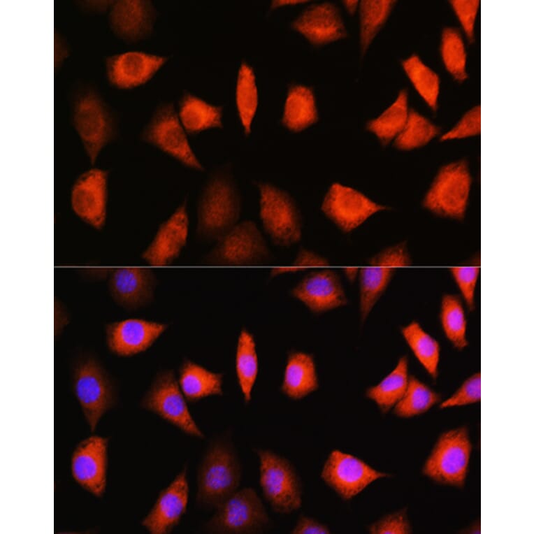 Immunofluorescence - Anti-KIFAP3 Antibody (A14579) - Antibodies.com