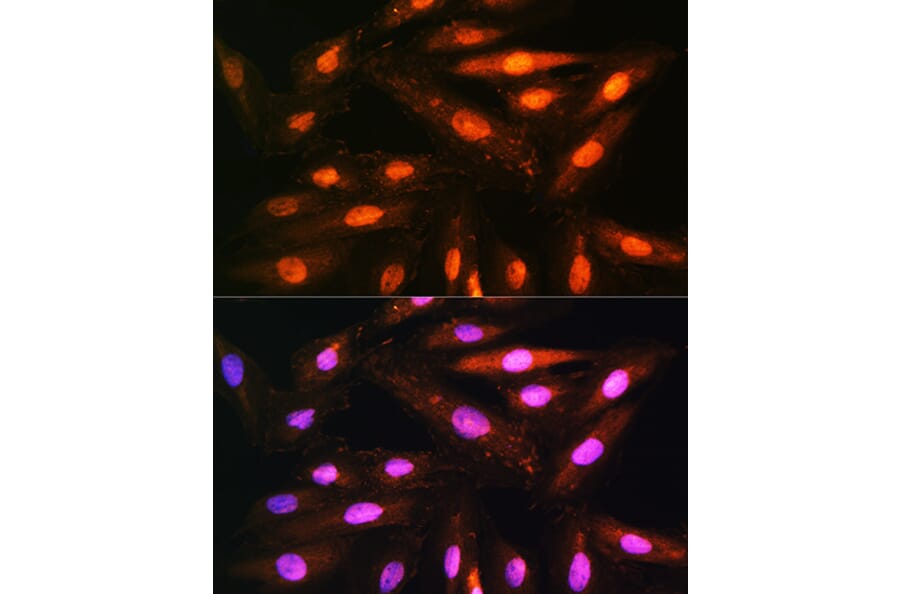 Immunofluorescence - Anti-KIFAP3 Antibody (A14579) - Antibodies.com