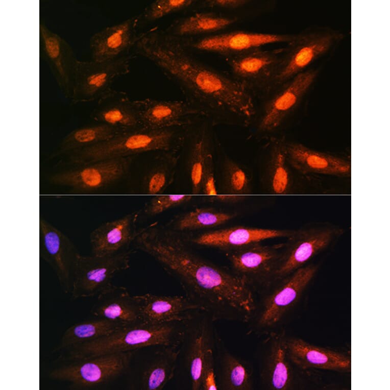 Immunofluorescence - Anti-KIFAP3 Antibody (A14579) - Antibodies.com