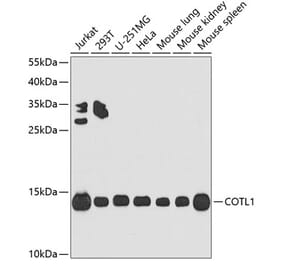 Western Blot - Anti-COTL1 Antibody (A14581) - Antibodies.com