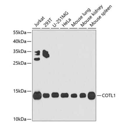 Western Blot - Anti-COTL1 Antibody (A14581) - Antibodies.com