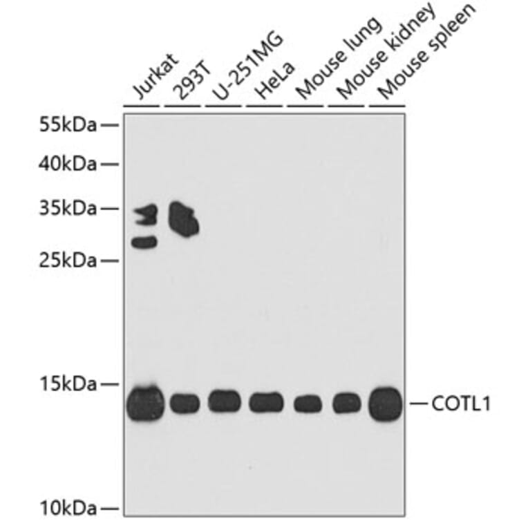 Western Blot - Anti-COTL1 Antibody (A14581) - Antibodies.com