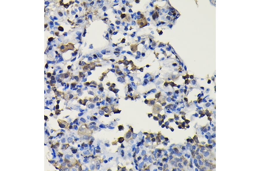 Immunohistochemistry - Anti-COTL1 Antibody (A14581) - Antibodies.com