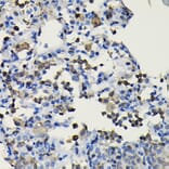 Immunohistochemistry - Anti-COTL1 Antibody (A14581) - Antibodies.com