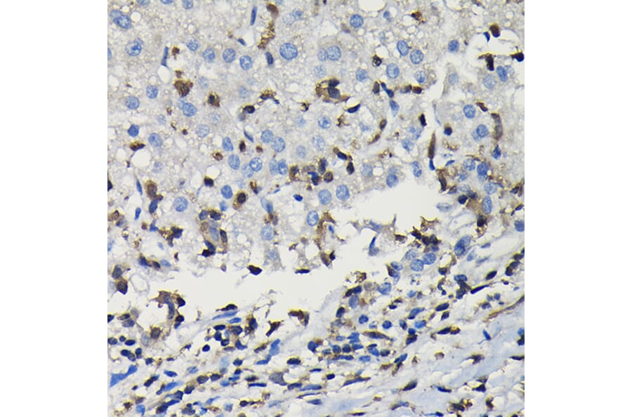 Immunohistochemistry - Anti-COTL1 Antibody (A14581) - Antibodies.com
