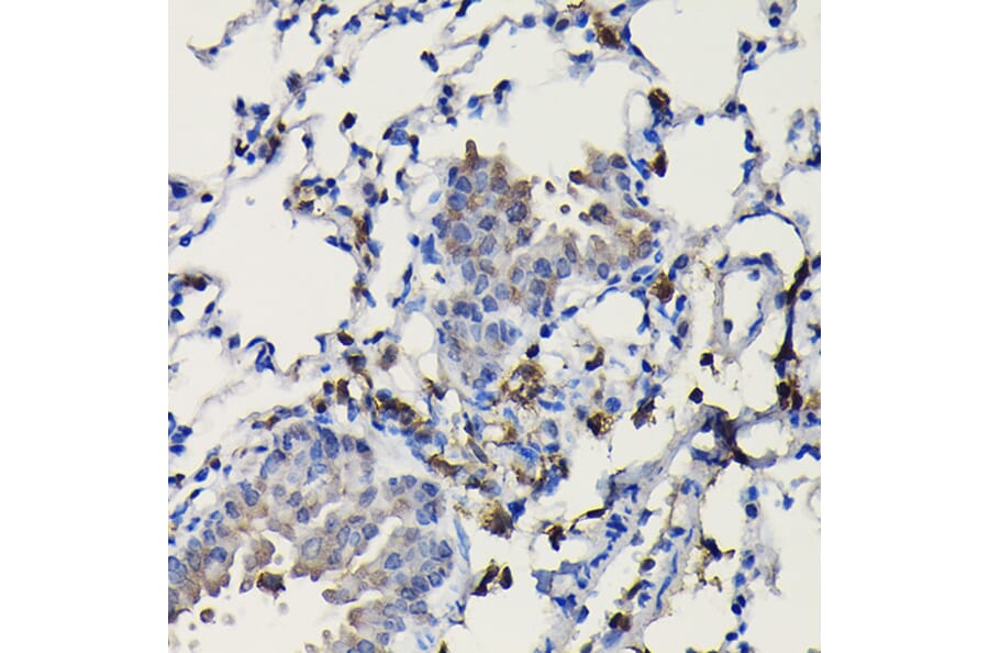 Immunohistochemistry - Anti-COTL1 Antibody (A14581) - Antibodies.com